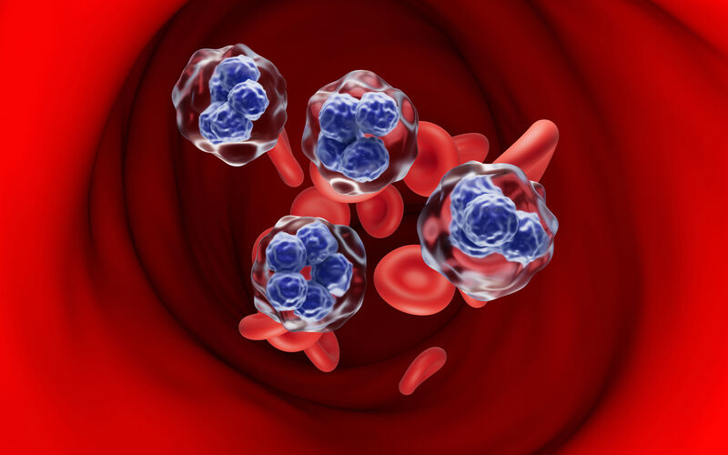 graphic of t-cell lymphoma cells in the blood