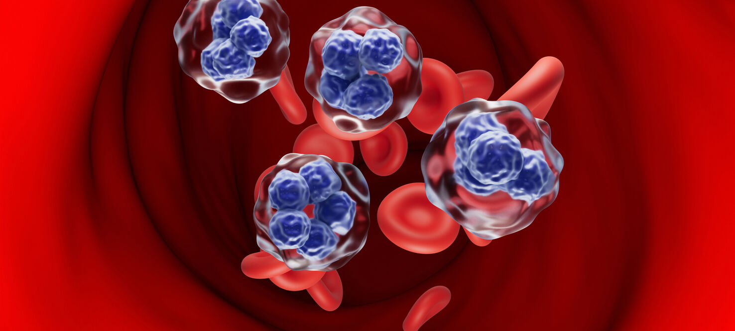 graphic of t-cell lymphoma cells in the blood