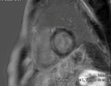 Picture 3 Clinical case CCVG insights Vol13_escardio-hPhotoMedium.png