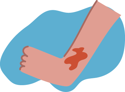 injured ankle without treatment