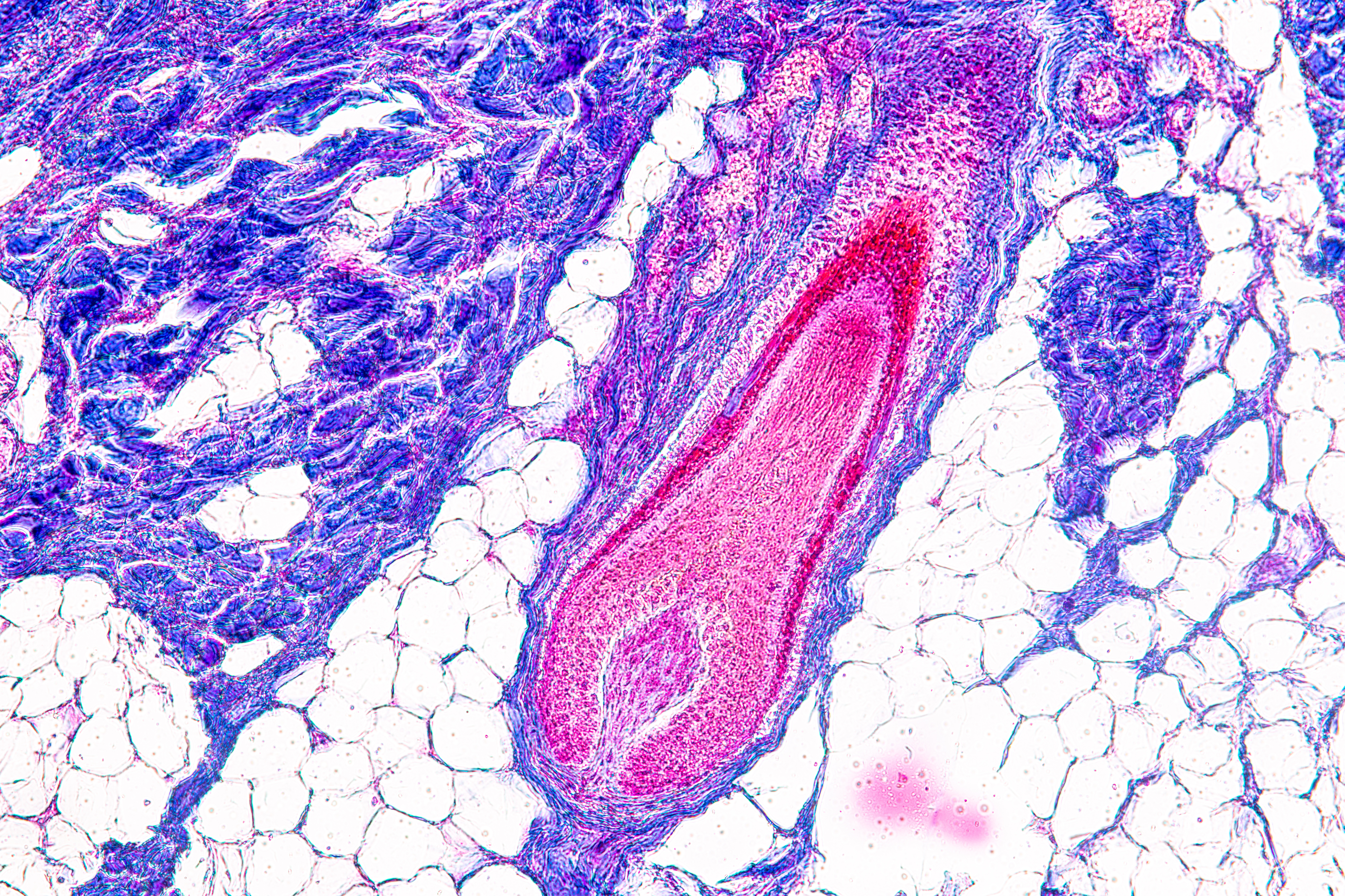 Scalp and hair follicles_507718120.jpeg