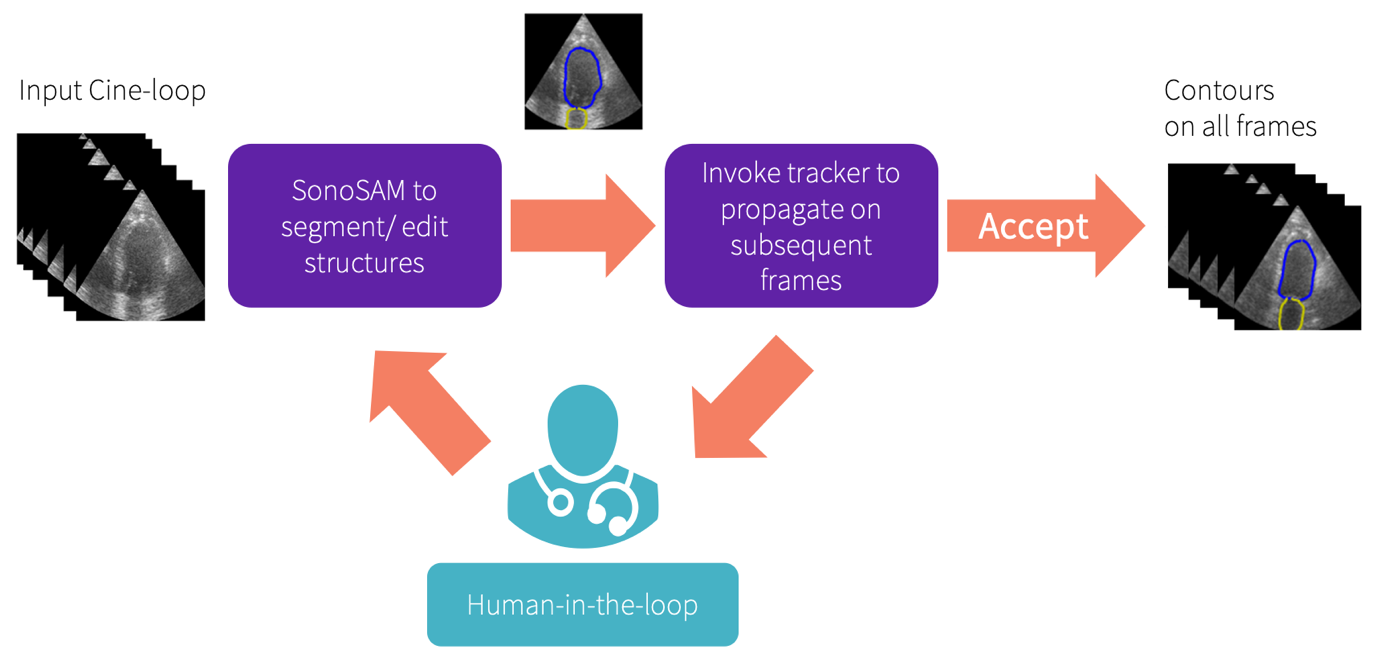 A diagram of an ultrasoundDescription automatically generated