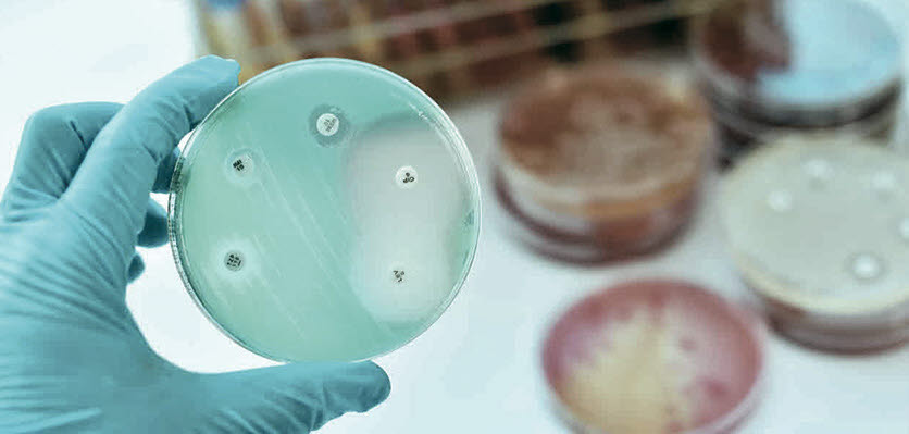 public health - petri dish - content page hero.jpg