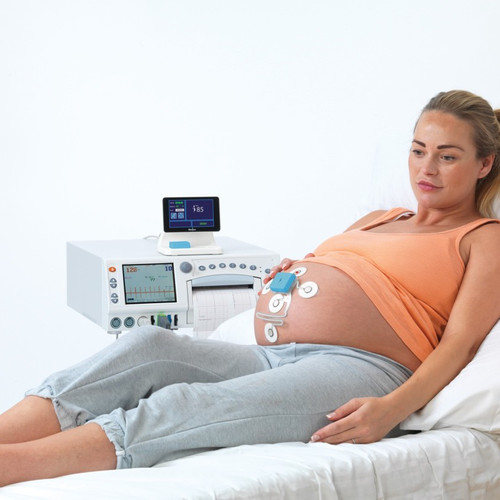 Expectant mother with Novii wireless monitor