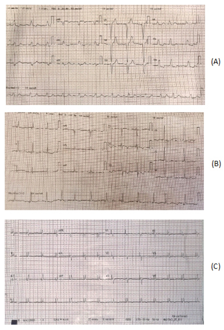 281_Ibrahim_Figure 1_Resynchronisation.jpg