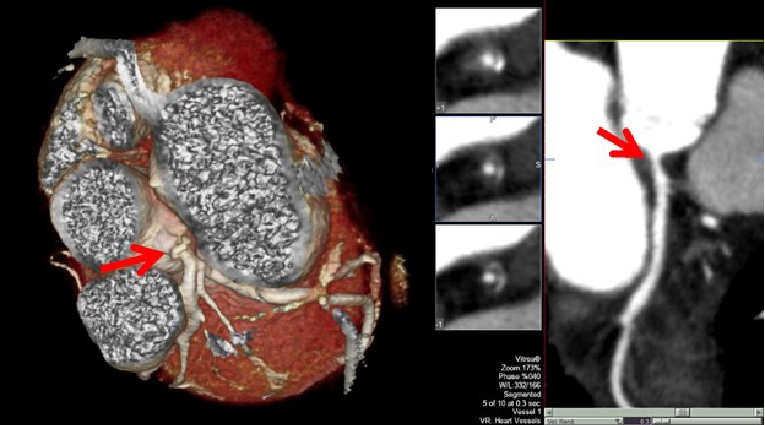 162_Lopez-Fernandez_figure 1_Cardio-oncology it is not only heart failure.jpg