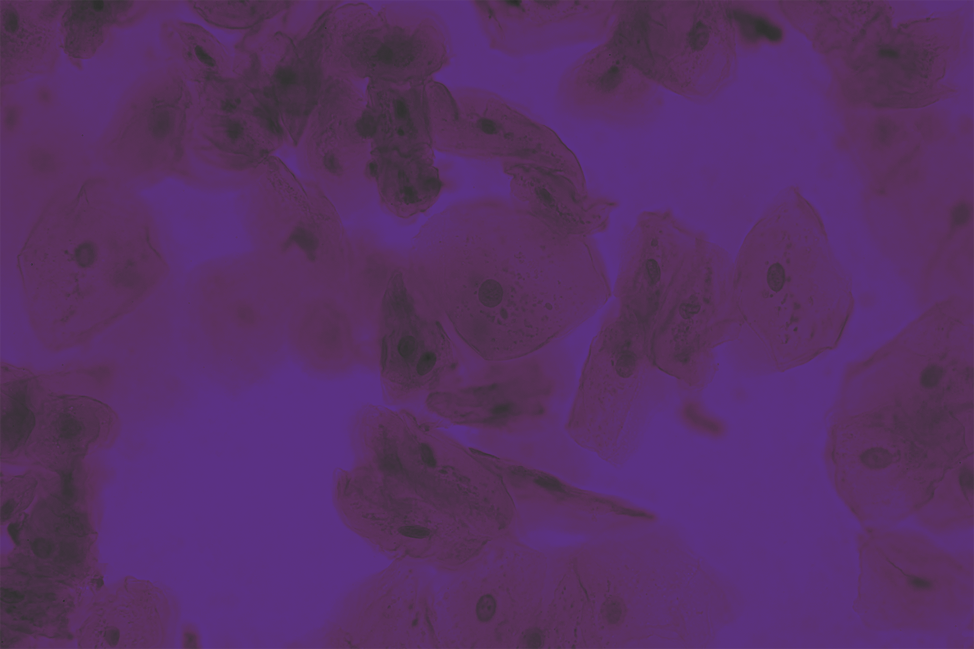 Human cheek epithelial cells_310327942.png