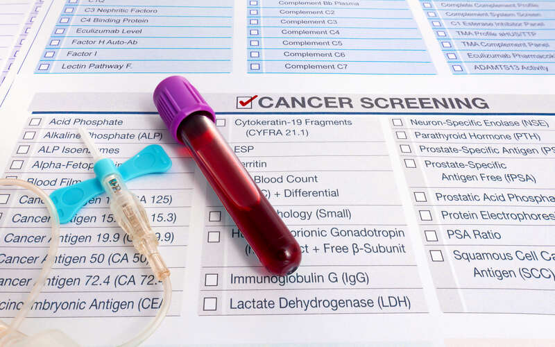 image of cancer screening form and test tube of blood