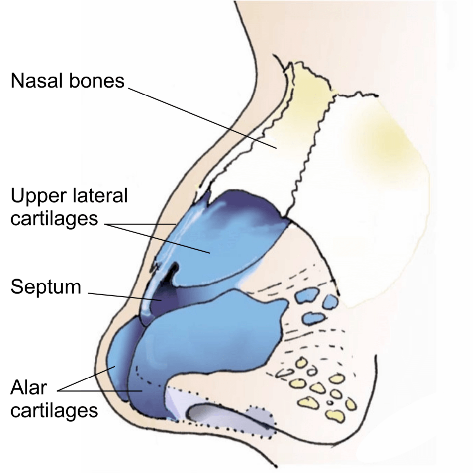 Illustration showing the bones and cartilage of the nose; nasal bones, upper lateral cartilages, septum and alar cartilages.