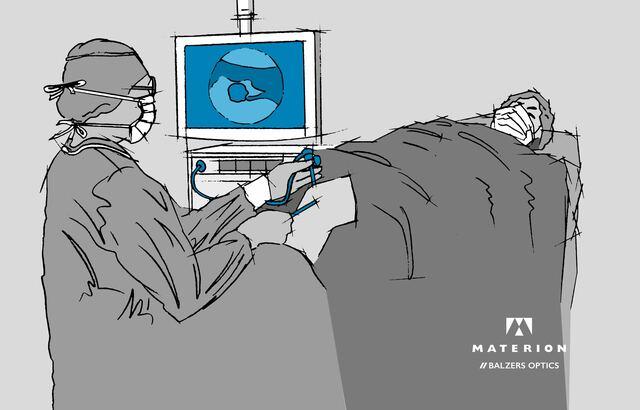 Illustration Endoscopy