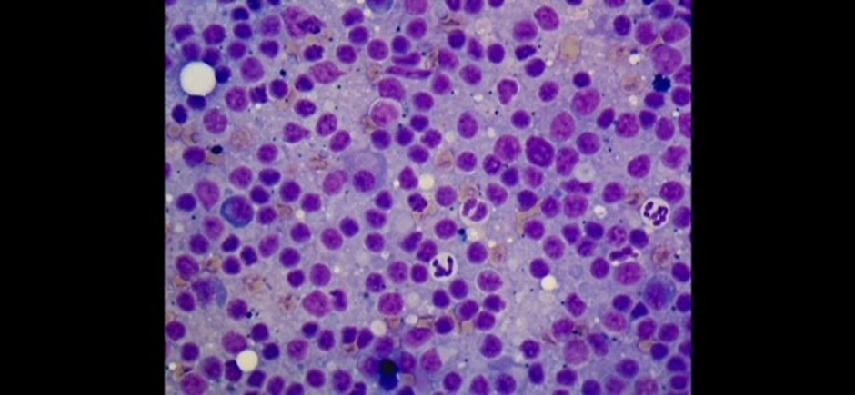 Sue Beetson's purple image