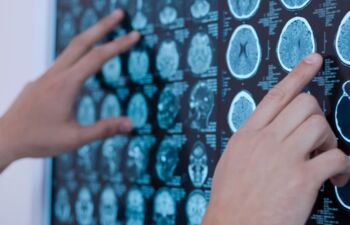 brain scan .png