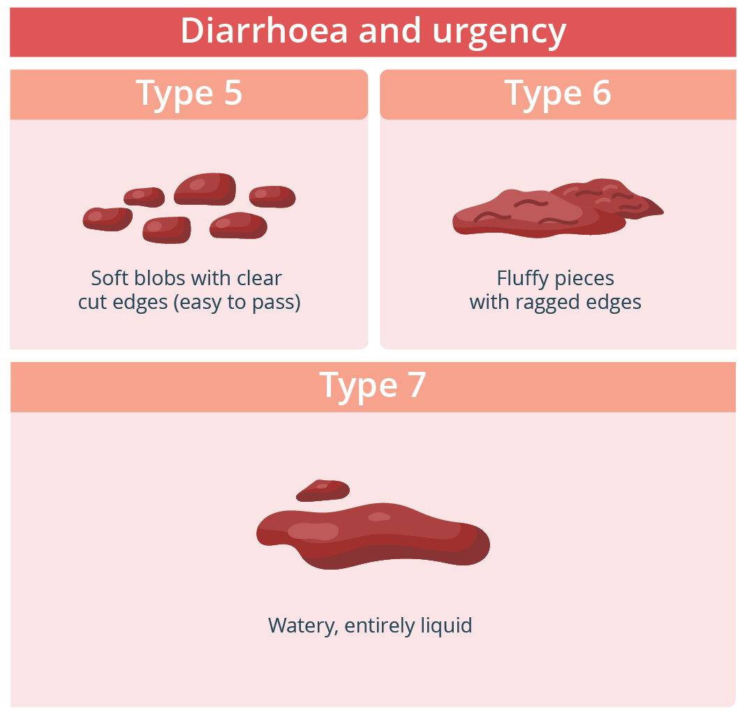 Illustration of types of poo's that could mean you are experiencing diarrhoea or may have irritable bowel syndrome (IBS)