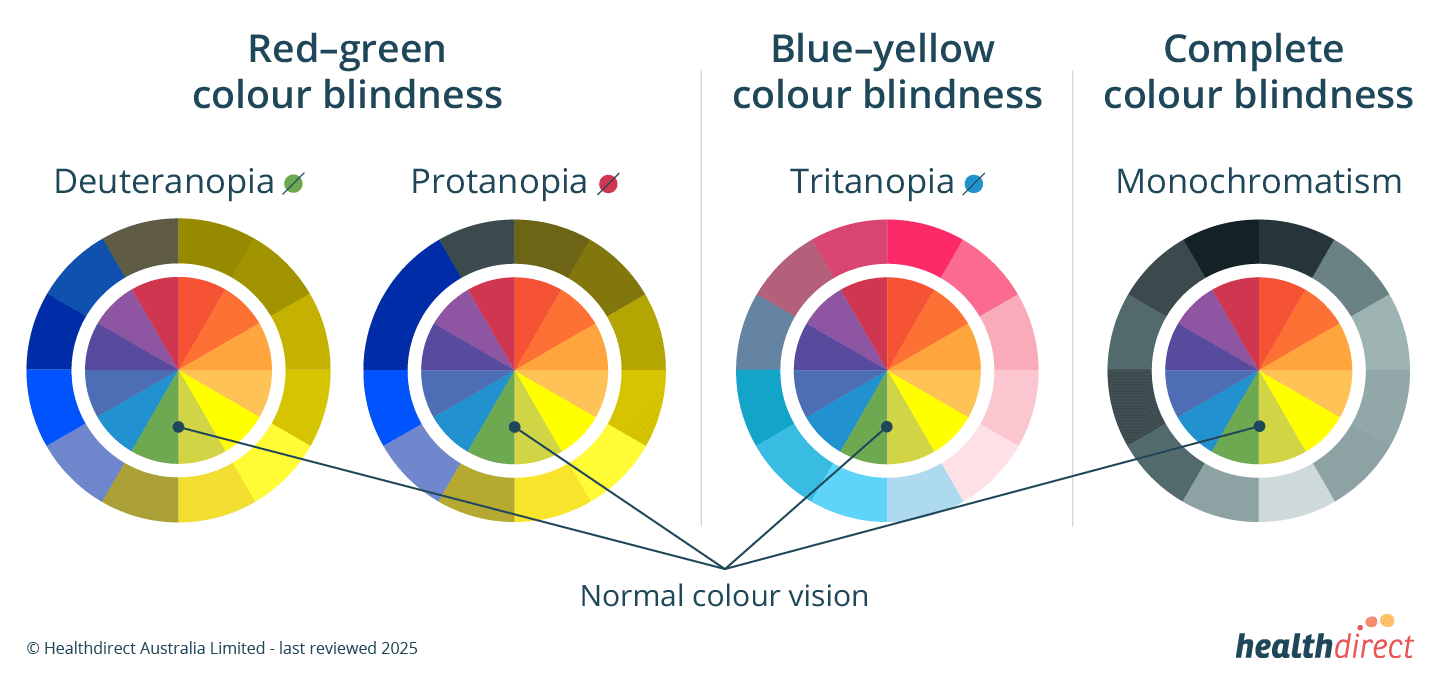 The varying colours those with red-green, blue-yellow and complete colour blindness see, against the normal vision wheel.