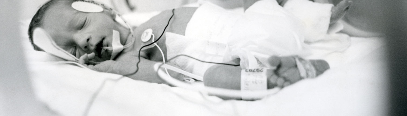Premature baby in NICU