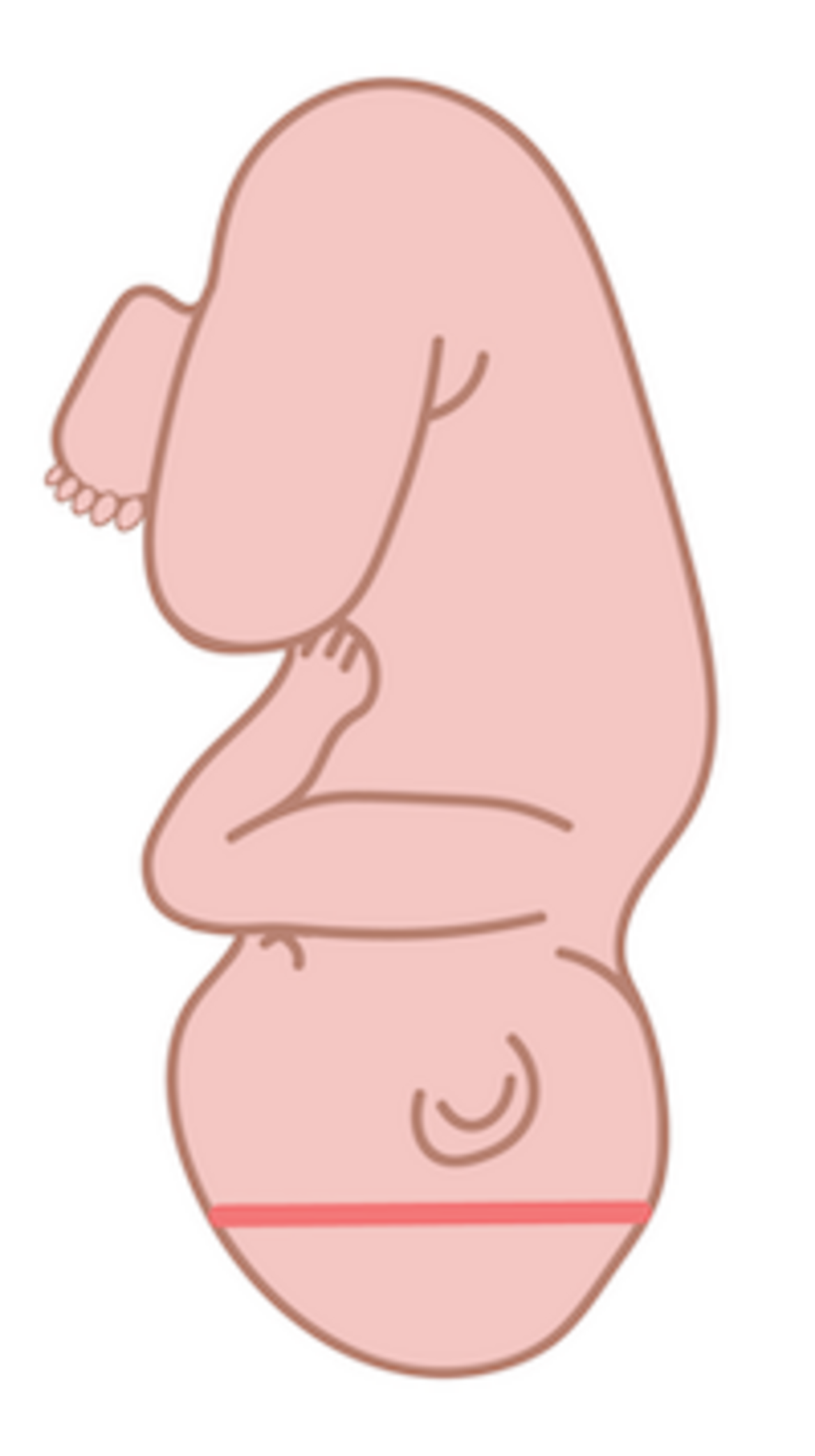 Vertex presentation, showing the narrow part of the baby’s head.