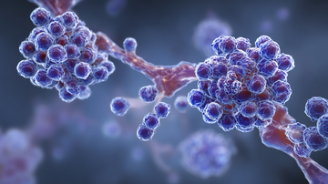 AdobeStock_1660620251_Amyloidosis protein buildup visualization rare systemic disorder illustration.